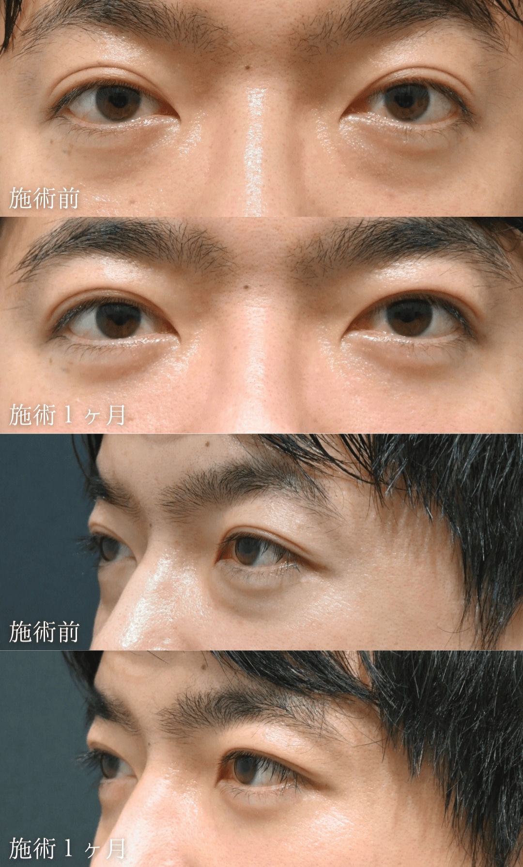 30代男性「疲れてる？ともう言われたくない。」
